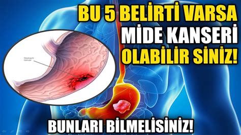 Bu Belirtiler Varsa Mide Kanseri Olabilirsiniz Yi Gelen Y Ntem Youtube