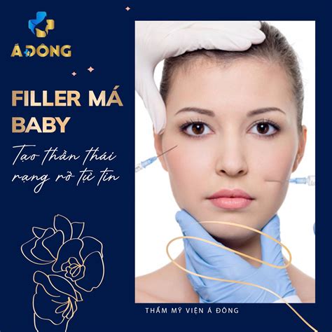 Filler Má Baby Thẩm Mỹ And Nha Khoa Á Đông