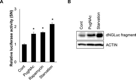 O Glcnacylation Of Atg B Enhances Proteolytic Activity Of Atg B A