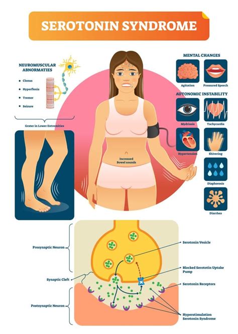 How To Increase Serotonin Naturally And With Medication