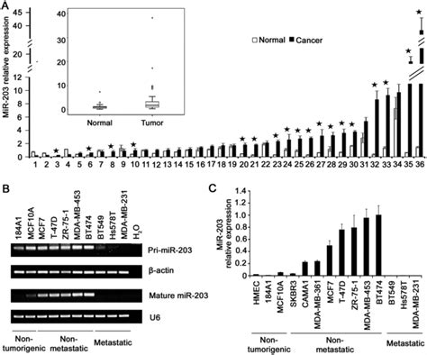 Epigenetic Silencing Of Mir 203 Upregulates Snai2 And Contributes To