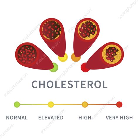 Cholesterol Levels Conceptual Illustration Stock Image F