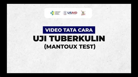 Tata Cara Uji Tuberkulin Mantoux Test Youtube