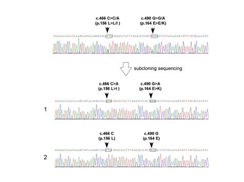 A Novel Mutation In Exon 2 Of The Myostatin Gene A Part Of The