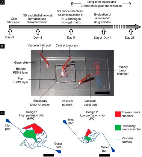 Frontiers Biomimetic Microfluidic Platforms For The Assessment Of Breast Cancer Metastasis