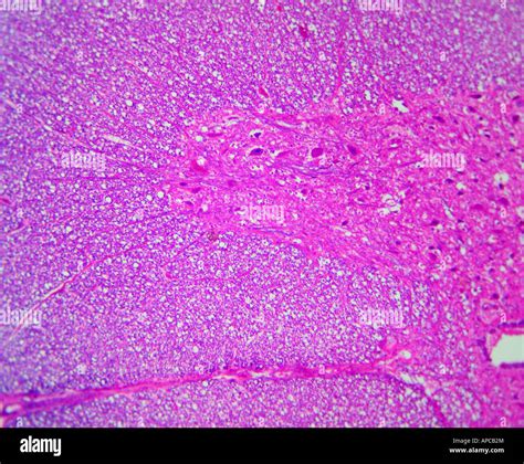 Spinal Cord Cross Section Hi Res Stock Photography And Images Alamy