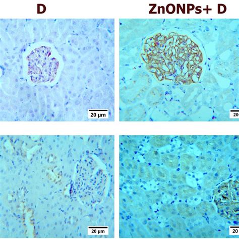 A Representative Nephrin And Podocin Immunohistochemical Staining Of