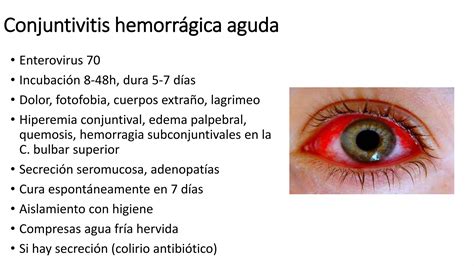 Conjuntivitis Viral Bact Alergica Pptx Descarga Gratuita