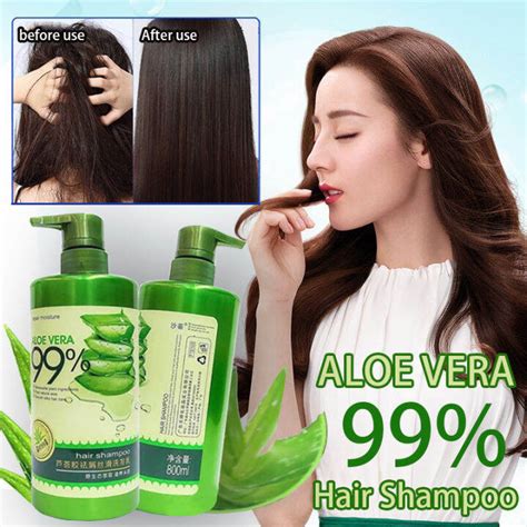 aloe vera shampoo and conditioner Original 100% Aloe Vera Anti-Dandruff ...