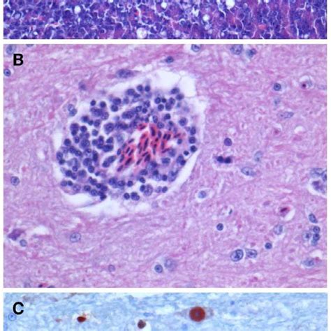 Pathology Of Highly Pathogenic Avian Influenza Virus H5n1 Infection In