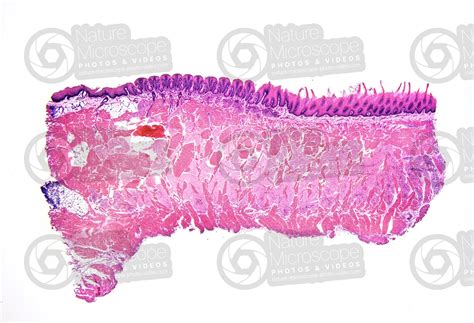 Man Tongue Longitudinal Section X Mouth Man Mammals