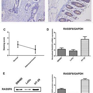 Rassf Expression In Colon Tissues And Crc Cell Lines A