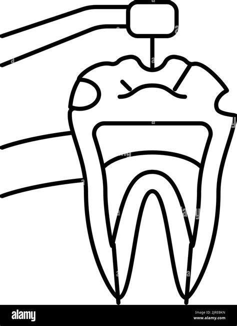 Caries Treatment Black And White Stock Photos And Images Alamy