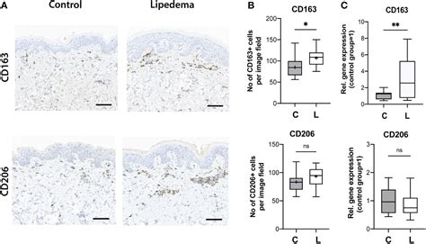 Frontiers A Distinct M2 Macrophage Infiltrate And Transcriptomic Profile Decisively Influence