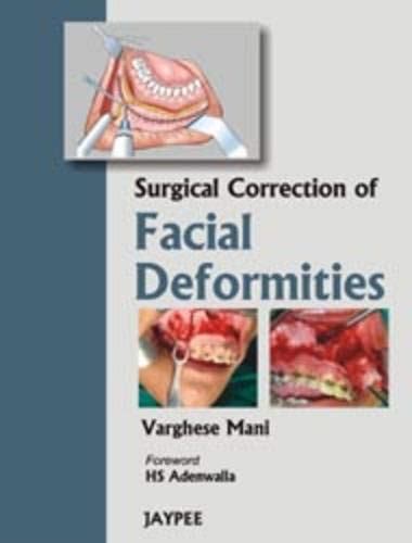 Surgical Correction Of Facial Deformities Br