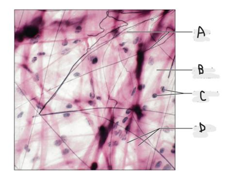 A&P Lab 3 Connective Tissue Examples Flashcards | Quizlet