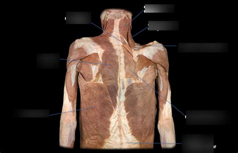 Diagrama de Músculos del dorso I Quizlet