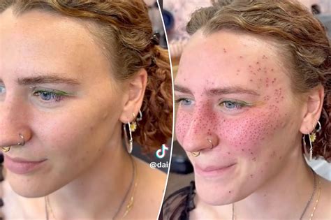 I Got Freckle Tattoos — People Say They Will Age Like A Tramp Stamp