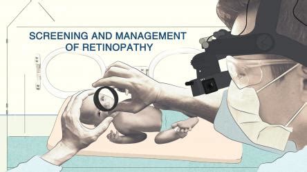 Guidelines For The Management Of Retinopathy Of Prematurity Prevention