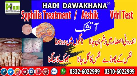 Atshik Ka Ilaj Syphilis Ka Ilaj Atshik Ki Alamat Or Wajuhat Vdrl