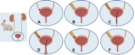 Schematic Illustration Of The Surgical Procedure A Ligation Of The