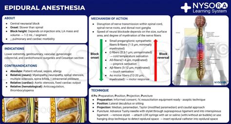 Epidural Anesthesia And Analgesia Nysora Nysora Anesthesia