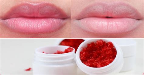 10 Home Remedies To Lighten Dark Lips