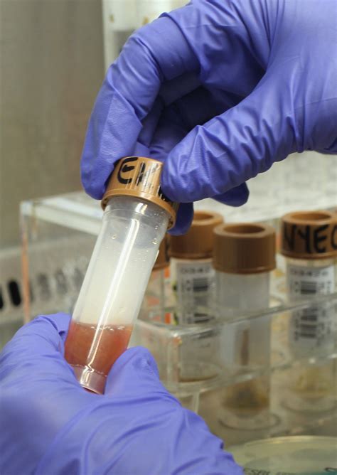 Diese Symptome sollte man nie ignorieren - Wann man sofort zum Arzt