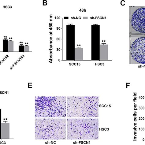 FSCN1 Inhibition Suppressed Cell Proliferation And Invasion In OSCC