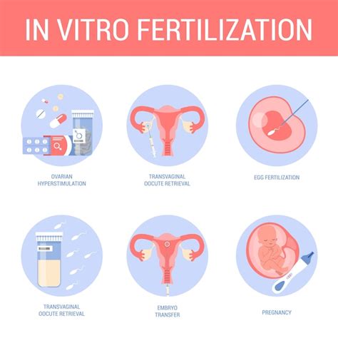 Método de fertilización in vitro paso a paso embarazo artificial con