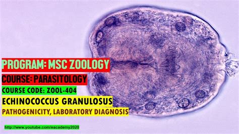 Echinococcus Granulosus Pathogenicity And Laboratory Diagnosis Youtube