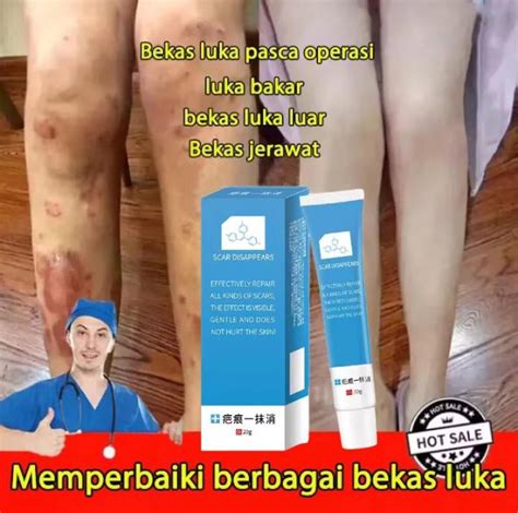 Scar Removal Gel Menghilangkan Bekas Luka Dengan Cepat Penghilang