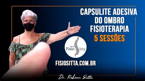 Capsulite Adesiva Do Ombro Congelado Tratamento De Fisioterapia