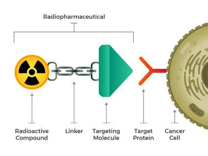 Radiation Therapy for Cancer - NCI