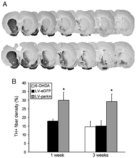 Parkin Protects Against Neurotoxicity In The 6 Hydroxydopamine Rat