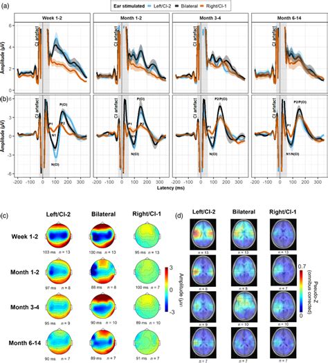 Evoked Potentials With Increased Bilateral Ci Use A Global Field Download Scientific Diagram