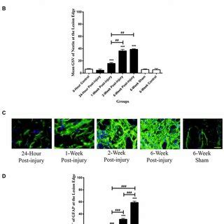 Co Labeling Of Nestin And Glial Fibrillary Acidic Protein GFAP In Rat