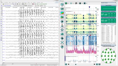 Neurovirtual Sleepvirtual Bwiii Plus Full Eeg And Psg