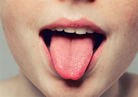 Check This Color In The Tongue Indicates Deadly Anemia My Healthygram