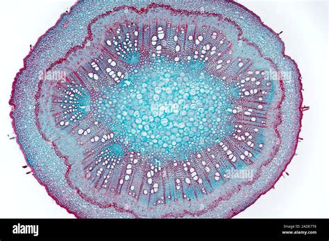 Annual Stem Of Eucalyptus Light Micrograph Of A Cross Section Through