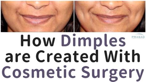 Facelift Surgery And Eyelid Surgery By Dr Amiya Prasad New York