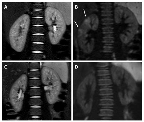 Jcm Free Full Text Diffusion Weighted Mri In The Evaluation Of