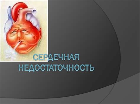 Сердечная недостаточность - презентация онлайн