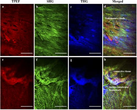 Figure From Miniaturized Multimodal Multiphoton Microscope For