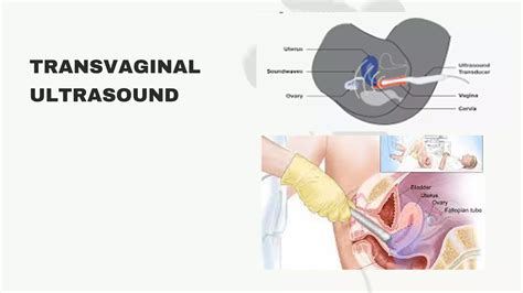 Types Of Ultrasound Scan Pdf