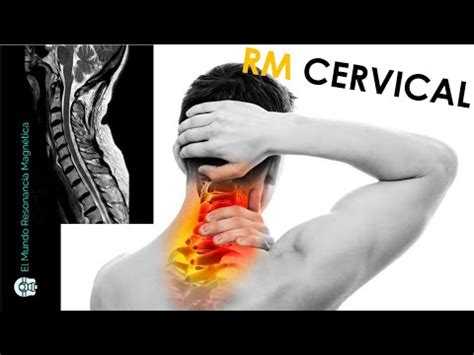 Cómo se hace una Resonancia Magnética de columna Cervical en