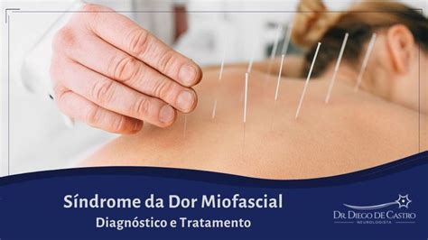 Dor Miofascial Pode Ser Diagnosticada Por Meio De Avalia O Cl Nica