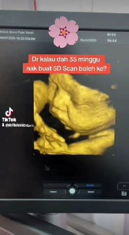 Nk Scan D Jom Ker Klinik Nova Jam Terengganu Pregnant Trending