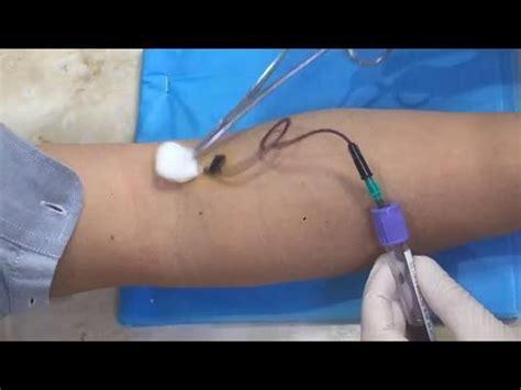 Phlebotomist YouTube