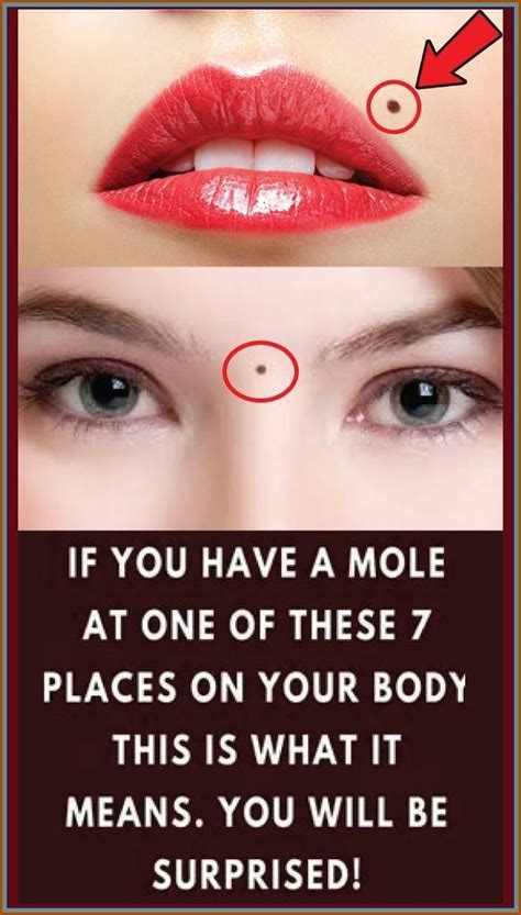 If You Have A Mole At One Of These Places On Your Body This Is What